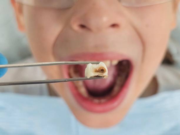 Fast & Reliable Emergency Dental Services in WY